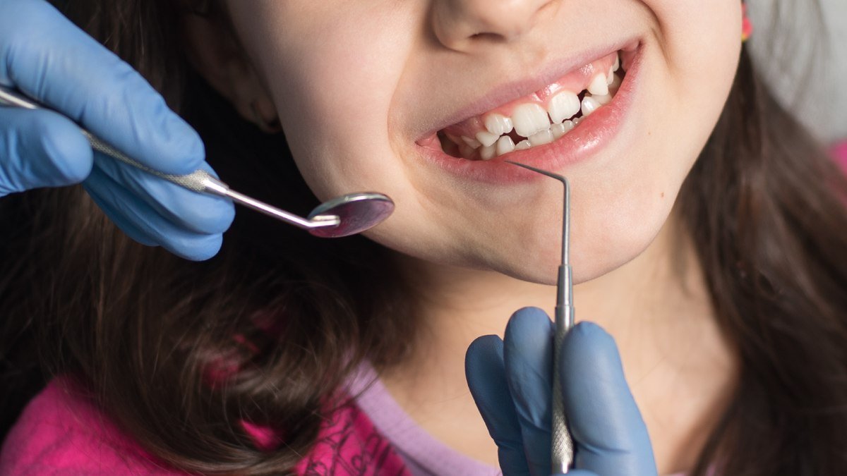 Child smiling in a dental chair during a preventive dental sealant visit in Orlando