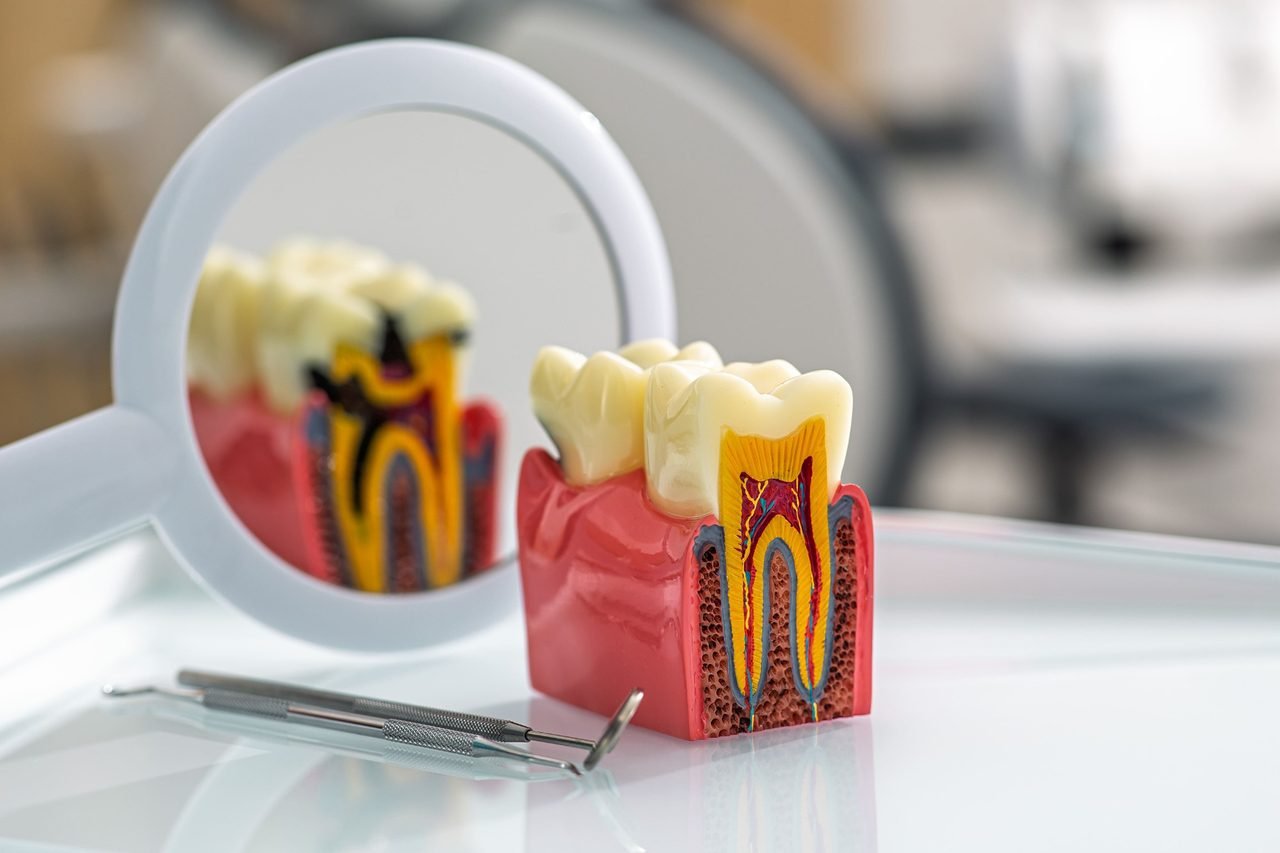 How gum and bone support each tooth Cross-section tooth model showing enamel, gum and bone beside a dental mirror and instruments