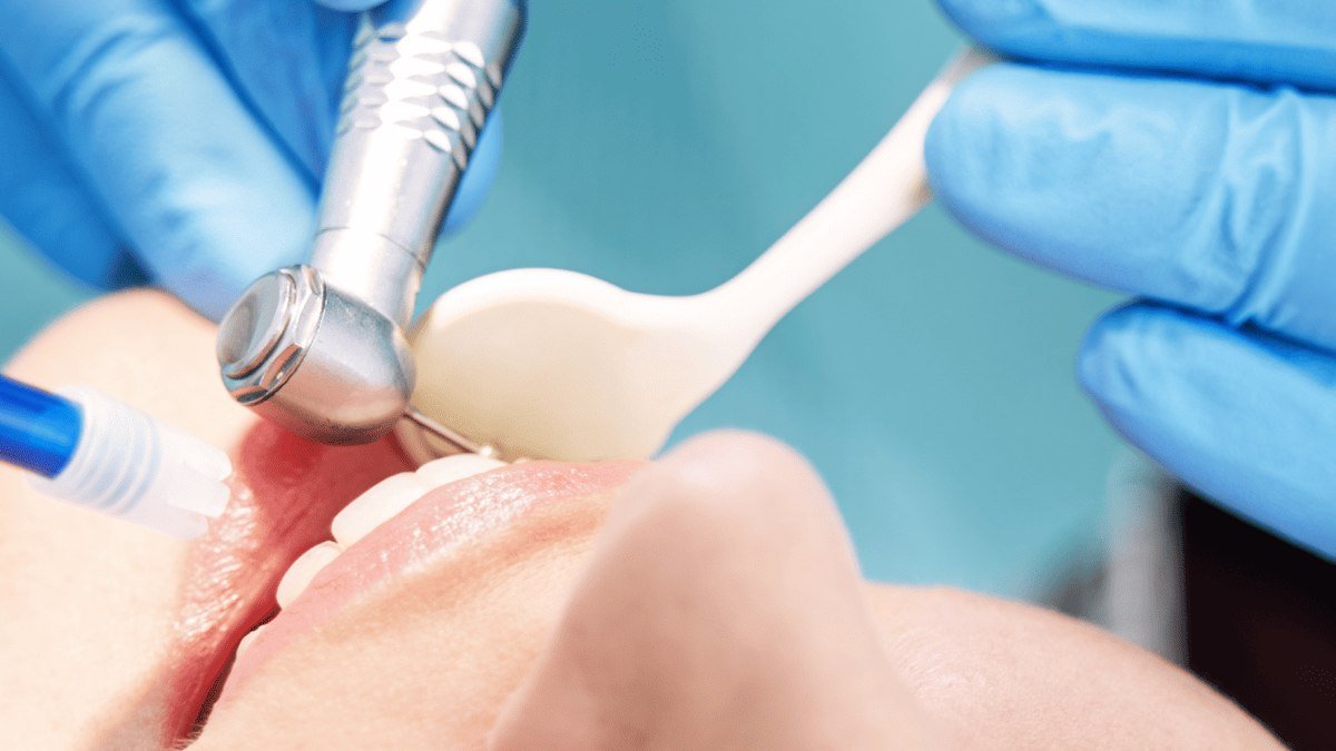A patient receiving treatment calmly during a monitored sedation dentistry visit