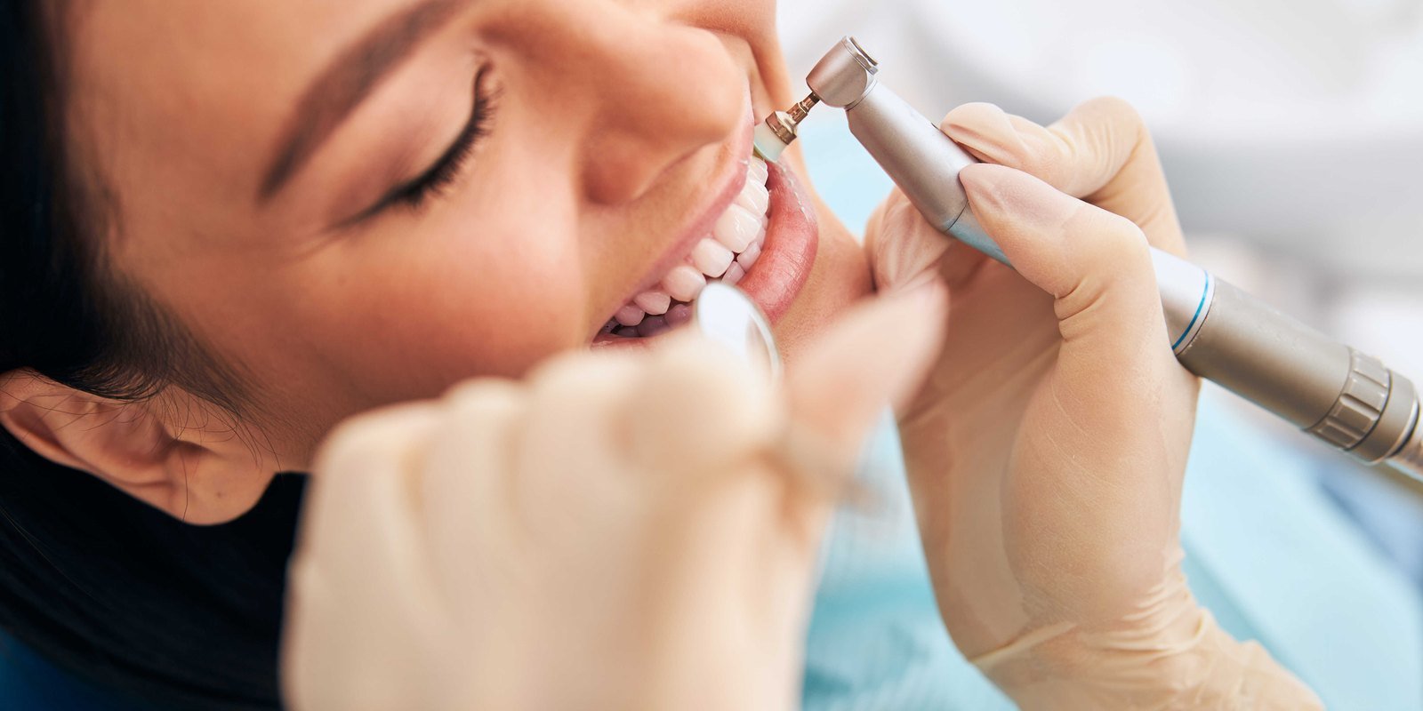 A patient smiling before a professional teeth cleaning in Orlando