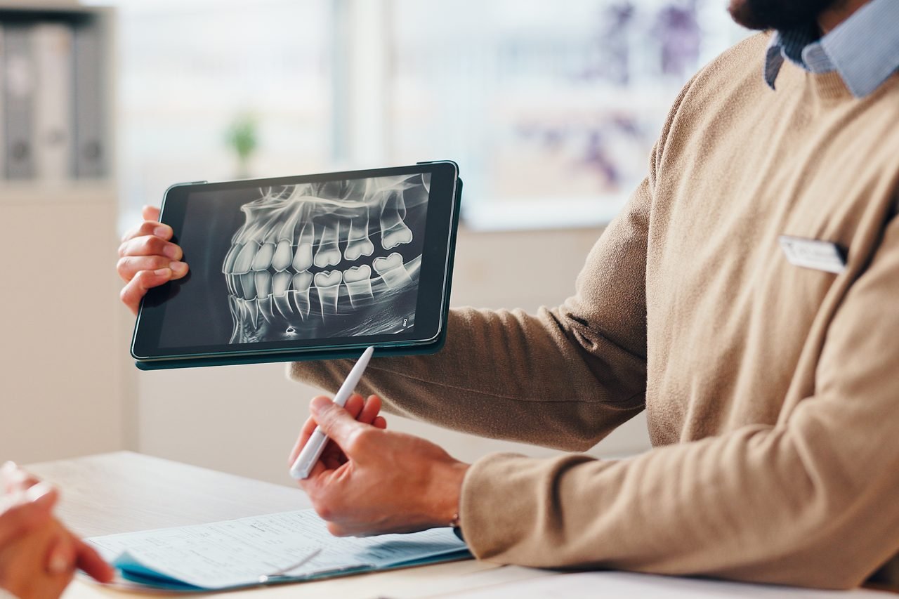 Reviewing an x-ray before wisdom tooth surgery Dentist pointing at a dental x-ray on a tablet while explaining a procedure to a patient